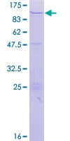 ZNF84 Protein - 12.5% SDS-PAGE of human ZNF84 stained with Coomassie Blue