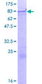 ZNF85 / HPF4 Protein - 12.5% SDS-PAGE of human ZNF85 stained with Coomassie Blue