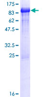 ZNF851 / ZBTB44 Protein - 12.5% SDS-PAGE of human ZBTB44 stained with Coomassie Blue