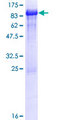 ZNF851 / ZBTB44 Protein - 12.5% SDS-PAGE of human ZBTB44 stained with Coomassie Blue