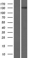 ZNF862 Protein - Western validation with an anti-DDK antibody * L: Control HEK293 lysate R: Over-expression lysate