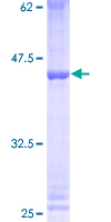 ZNF93 Protein - 12.5% SDS-PAGE of human ZNF93 stained with Coomassie Blue