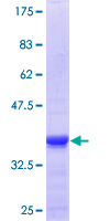 ZNFX1 Protein - 12.5% SDS-PAGE Stained with Coomassie Blue.