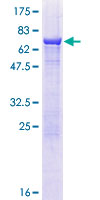 ZNHIT2 Protein - 12.5% SDS-PAGE of human ZNHIT2 stained with Coomassie Blue