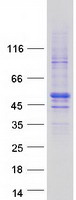 ZNHIT2 Protein - Purified recombinant protein ZNHIT2 was analyzed by SDS-PAGE gel and Coomassie Blue Staining
