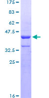 ZNHIT3 Protein - 12.5% SDS-PAGE of human ZNHIT3 stained with Coomassie Blue
