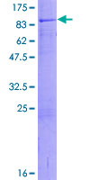 ZNHIT6 / C1orf181 Protein - 12.5% SDS-PAGE of human C1orf181 stained with Coomassie Blue