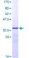ZNRD1 Protein - 12.5% SDS-PAGE Stained with Coomassie Blue.