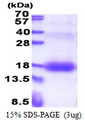 ZNRD1 Protein
