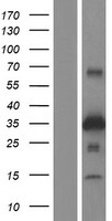 ZNRF1 Protein - Western validation with an anti-DDK antibody * L: Control HEK293 lysate R: Over-expression lysate