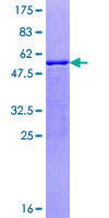 ZNRF1 Protein - 12.5% SDS-PAGE of human ZNRF1 stained with Coomassie Blue