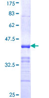 ZNRF1 Protein - 12.5% SDS-PAGE Stained with Coomassie Blue.