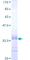 ZNRF2 Protein - 12.5% SDS-PAGE Stained with Coomassie Blue.