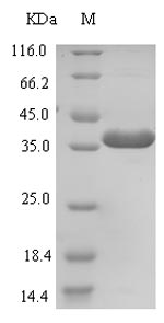 ZNRF3 Protein - (Tris-Glycine gel) Discontinuous SDS-PAGE (reduced) with 5% enrichment gel and 15% separation gel.