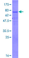 ZNRF4 Protein - 12.5% SDS-PAGE of human ZNRF4 stained with Coomassie Blue