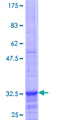 ZNRF4 Protein - 12.5% SDS-PAGE Stained with Coomassie Blue.
