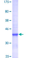 ZNT5 / SLC30A5 Protein - 12.5% SDS-PAGE of human SLC30A5 stained with Coomassie Blue