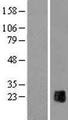 ZP2 Protein - Western validation with an anti-DDK antibody * L: Control HEK293 lysate R: Over-expression lysate