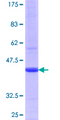 ZP2 Protein - 12.5% SDS-PAGE Stained with Coomassie Blue
