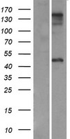 ZP3 Protein - Western validation with an anti-DDK antibody * L: Control HEK293 lysate R: Over-expression lysate