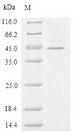 ZP3 Protein - (Tris-Glycine gel) Discontinuous SDS-PAGE (reduced) with 5% enrichment gel and 15% separation gel.