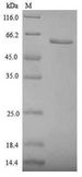 ZP3 Protein - (Tris-Glycine gel) Discontinuous SDS-PAGE (reduced) with 5% enrichment gel and 15% separation gel.