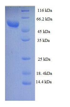 ZP3 Protein