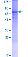 ZP3 Protein - 12.5% SDS-PAGE of human ZP3 stained with Coomassie Blue