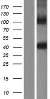 ZPBP / SP38 Protein - Western validation with an anti-DDK antibody * L: Control HEK293 lysate R: Over-expression lysate