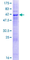 ZPBP2 Protein - 12.5% SDS-PAGE of human ZPBP2 stained with Coomassie Blue