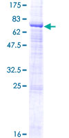 ZPLD1 Protein - 12.5% SDS-PAGE of human ZPLD1 stained with Coomassie Blue