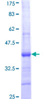 ZPLD1 Protein - 12.5% SDS-PAGE Stained with Coomassie Blue.