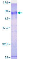 ZRANB2 / ZNF265 Protein - 12.5% SDS-PAGE of human ZNF265 stained with Coomassie Blue