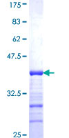 ZRP-1 / TRIP6 Protein - 12.5% SDS-PAGE Stained with Coomassie Blue.