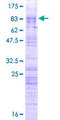 ZRSR2 Protein - 12.5% SDS-PAGE of human ZRSR2 stained with Coomassie Blue