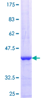 ZRSR2 Protein - 12.5% SDS-PAGE Stained with Coomassie Blue.