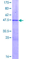 ZSCAN1 / MZF-1 Protein - 12.5% SDS-PAGE of human ZSCAN1 stained with Coomassie Blue