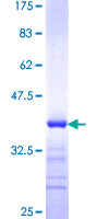 ZSCAN1 / MZF-1 Protein - 12.5% SDS-PAGE Stained with Coomassie Blue.