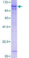 ZSCAN12 Protein - 12.5% SDS-PAGE of human ZNF305 stained with Coomassie Blue