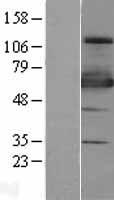 ZSCAN18 / ZNF447 Protein - Western validation with an anti-DDK antibody * L: Control HEK293 lysate R: Over-expression lysate