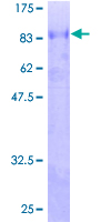 ZSCAN18 / ZNF447 Protein - 12.5% SDS-PAGE of human ZNF447 stained with Coomassie Blue