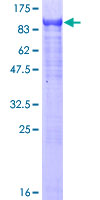 ZSCAN18 / ZNF447 Protein - 12.5% SDS-PAGE of human ZNF447 stained with Coomassie Blue