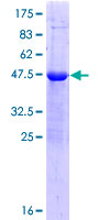 ZSCAN2 Protein - 12.5% SDS-PAGE of human ZSCAN2 stained with Coomassie Blue
