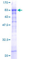 ZSCAN20 Protein - 12.5% SDS-PAGE of human ZNF31 stained with Coomassie Blue