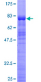 ZSCAN21 / Zipro1 Protein - 12.5% SDS-PAGE of human ZSCAN21 stained with Coomassie Blue