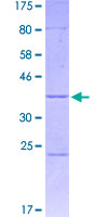ZSCAN21 / Zipro1 Protein - 12.5% SDS-PAGE Stained with Coomassie Blue.