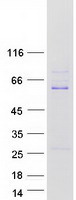 ZSCAN21 / Zipro1 Protein - Purified recombinant protein ZSCAN21 was analyzed by SDS-PAGE gel and Coomassie Blue Staining