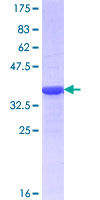 ZSCAN22 Protein - 12.5% SDS-PAGE Stained with Coomassie Blue.