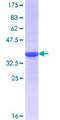 ZSCAN22 Protein - 12.5% SDS-PAGE Stained with Coomassie Blue.