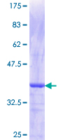 ZSCAN4 Protein - 12.5% SDS-PAGE Stained with Coomassie Blue.